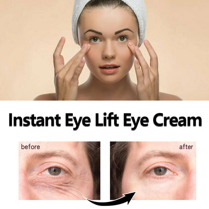 Hoygi Eye Lifting Eye Cream ផ្តល់សំណើម បន្តឹង និងកាត់បន្ថយស្នាមជ្រួញជុំវិញភ្នែក ប្រឆាំងភាពចាស់ Anti-Wrinkle Lifting Eye Cream 