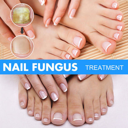 EELHOE Nail Repair Liquid Hand and Foot Onychomycosis Care Repair Onychomycosis Liquid Thickening soft Nails 