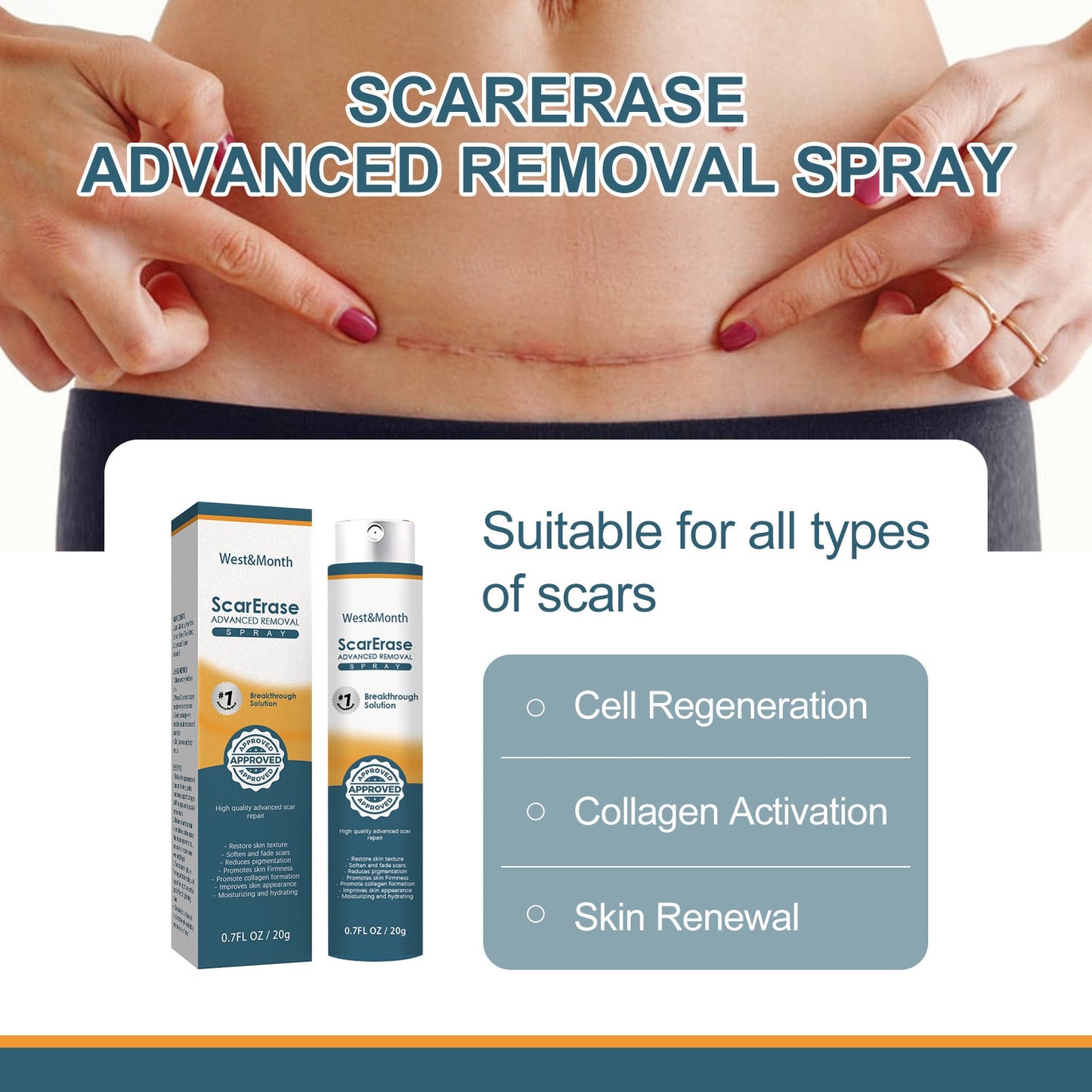 West&amp;Month Scar Repair Gel បំបាត់ស្លាកស្នាមលើស្បែក ជួសជុលស្នាមមុន ស្នាមសង្វារពេលមានផ្ទៃពោះ ធ្វើអោយស្បែករលោង 