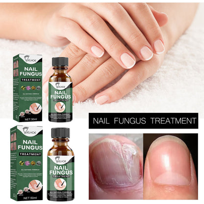 EELHOE nail repair liquid hand and foot repair liquid gray nail liquid concave and convex thick nail thickening type gray nail soft nail 