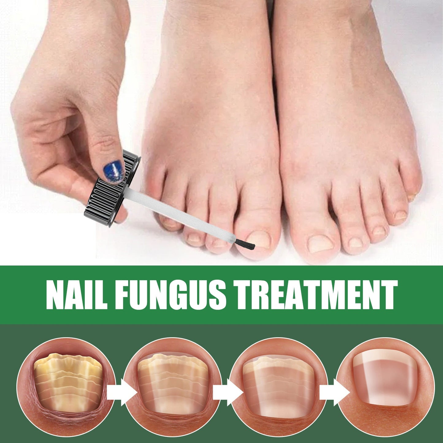 EELHOE Onychomycosis Repair Solution Toenail Tea Tree Oil Finger Thick Soft Nail Nutrition Hand and Foot Nail Care Solution 