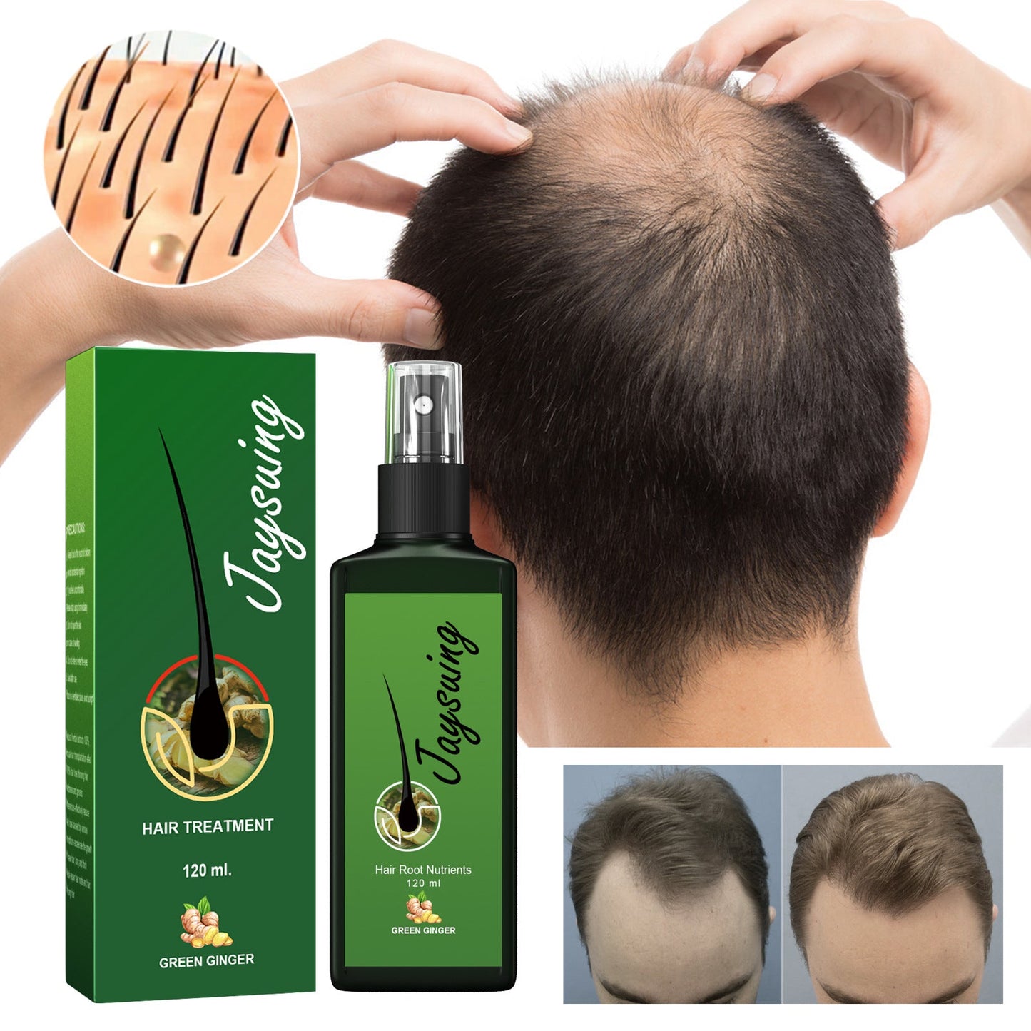 Jaysuing Hair Thickness Serum បណ្តុះសក់ ដុះក្រាស់ ចិញ្ចឹមឫសសក់ ពង្រឹងស្បែកក្បាល ម៉ាស្សា សារធាតុចិញ្ចឹម 