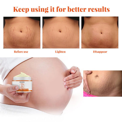 Stretch mark repair cream for pregnant women, firming and loosening, postpartum care, skin care, growth lines, improvement and fading lines, skin cream 