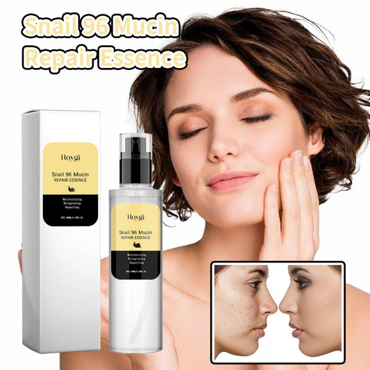 HOYGI Snail Collagen Essence បំបាត់ស្នាមអុចខ្មៅ និងផ្នត់ nasolabial បន្តឹងស្បែក ចិញ្ចឹម និងផ្តល់សំណើមដល់ស្បែក 