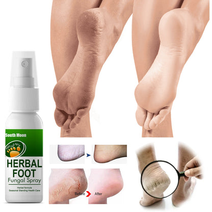 South Moon Herbal Foot Spray បាញ់បំបាត់ការរមាស់ជើងរបស់អត្តពលិក Deodorizing Peeling Foot Care Spray 