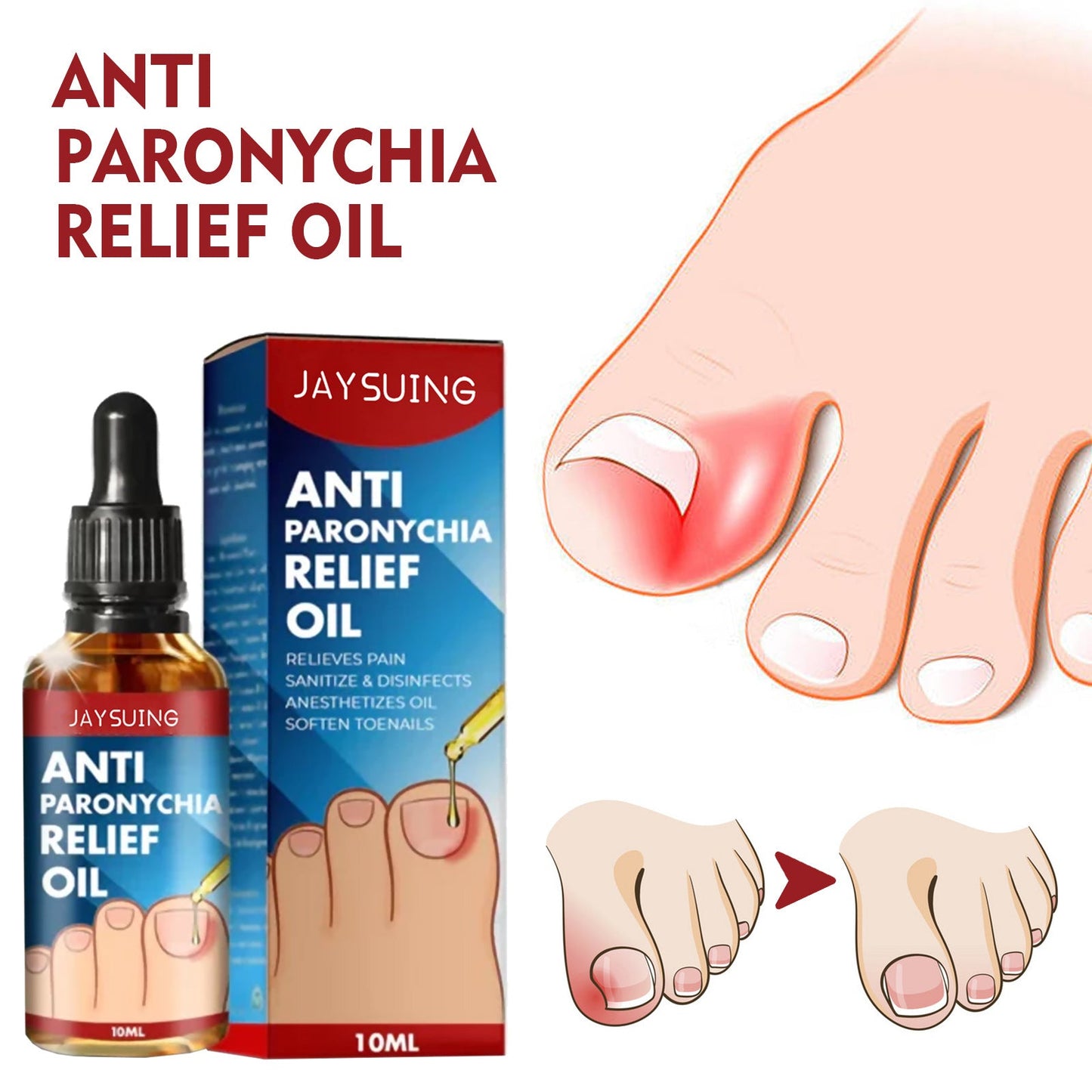 Jaysuing Anti-nail groove relief oil Soft nails Bright nails Repair ingrown nails Thickening type onychomycosis nail groove care oil 