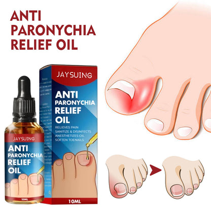 Jaysuing Anti-nail groove relief oil Soft nails Bright nails Repair ingrown nails Thickening type onychomycosis nail groove care oil 