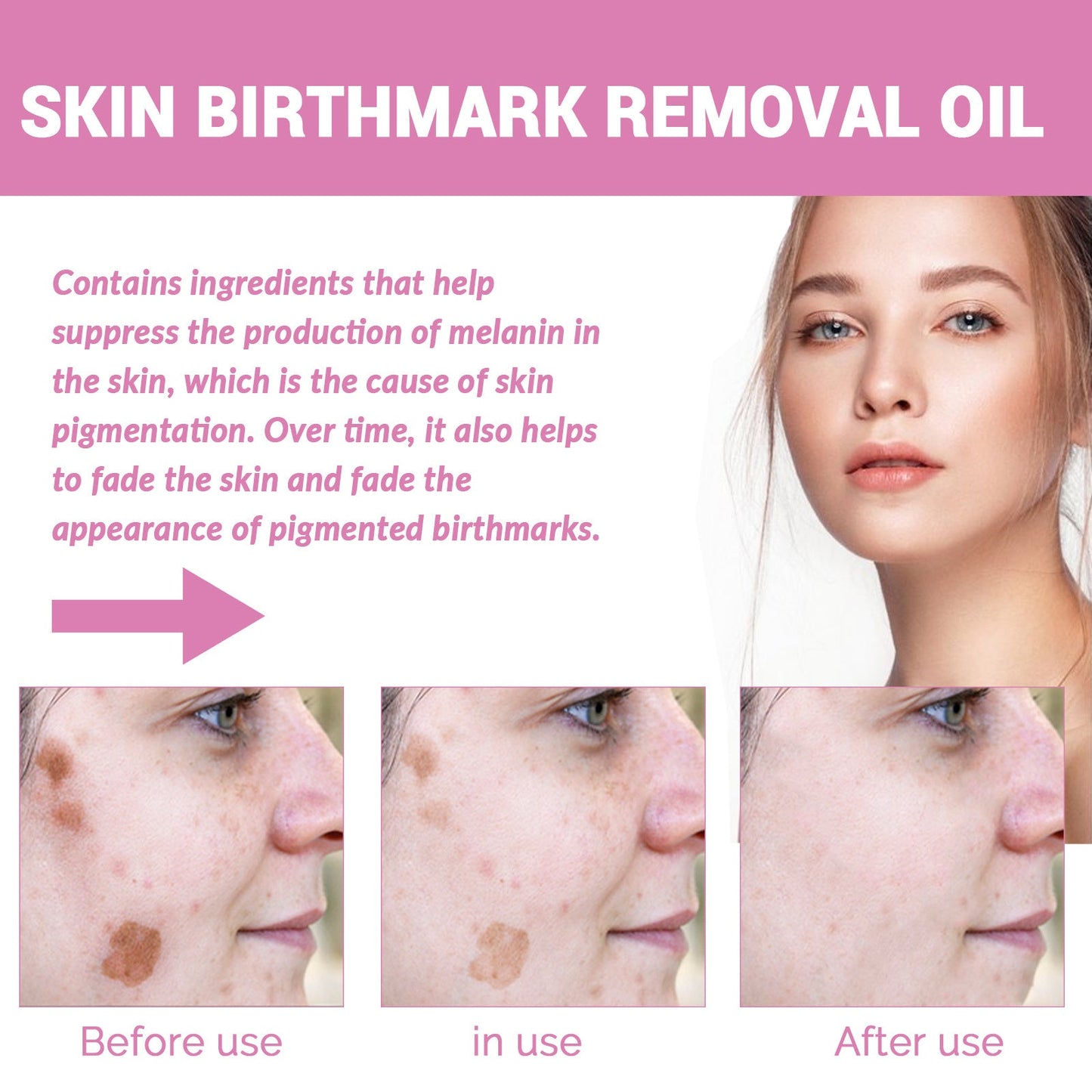 EELHOE skin repair oil ស្បែកមុខបាត់ស្នាមអុចខ្មៅ ស្នាមអុជកាហ្វេ ផ្តល់សំណើមដល់ស្បែកមុខ ប្រេងសំខាន់ៗ 