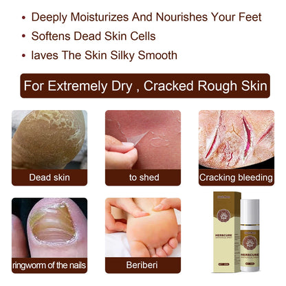 South Moon Herbal Foot Spray Foot Sweat Deodorant Spray Dehumidifier Spray Foot Odor Care Spray 