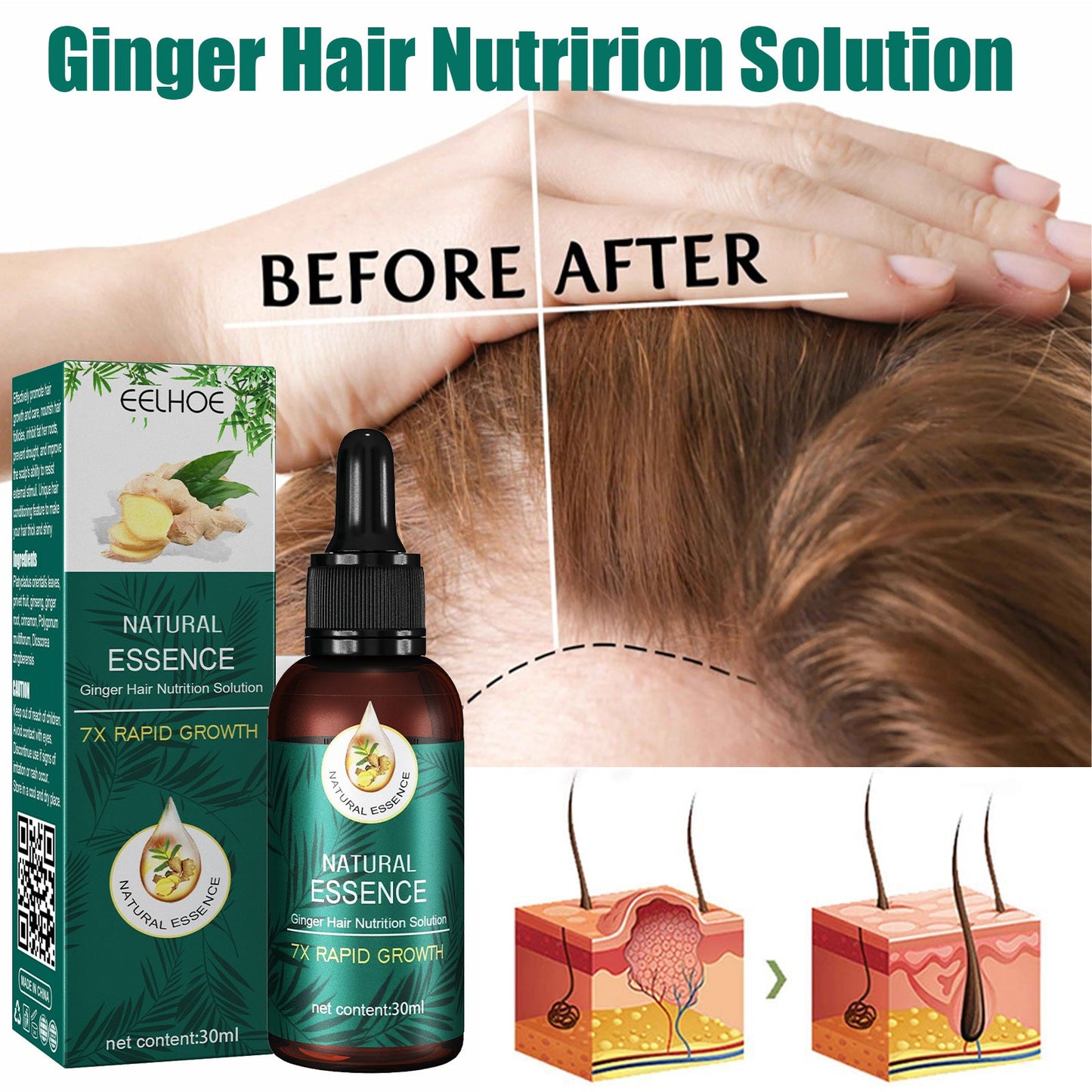 EELHOE Ginger Hair Care Essential Oil ជួសជុលឫសសក់ បណ្តុះសក់ ទន់រលោង ស្ងួត និងស្រួយ ប្រេងសំខាន់ៗ 