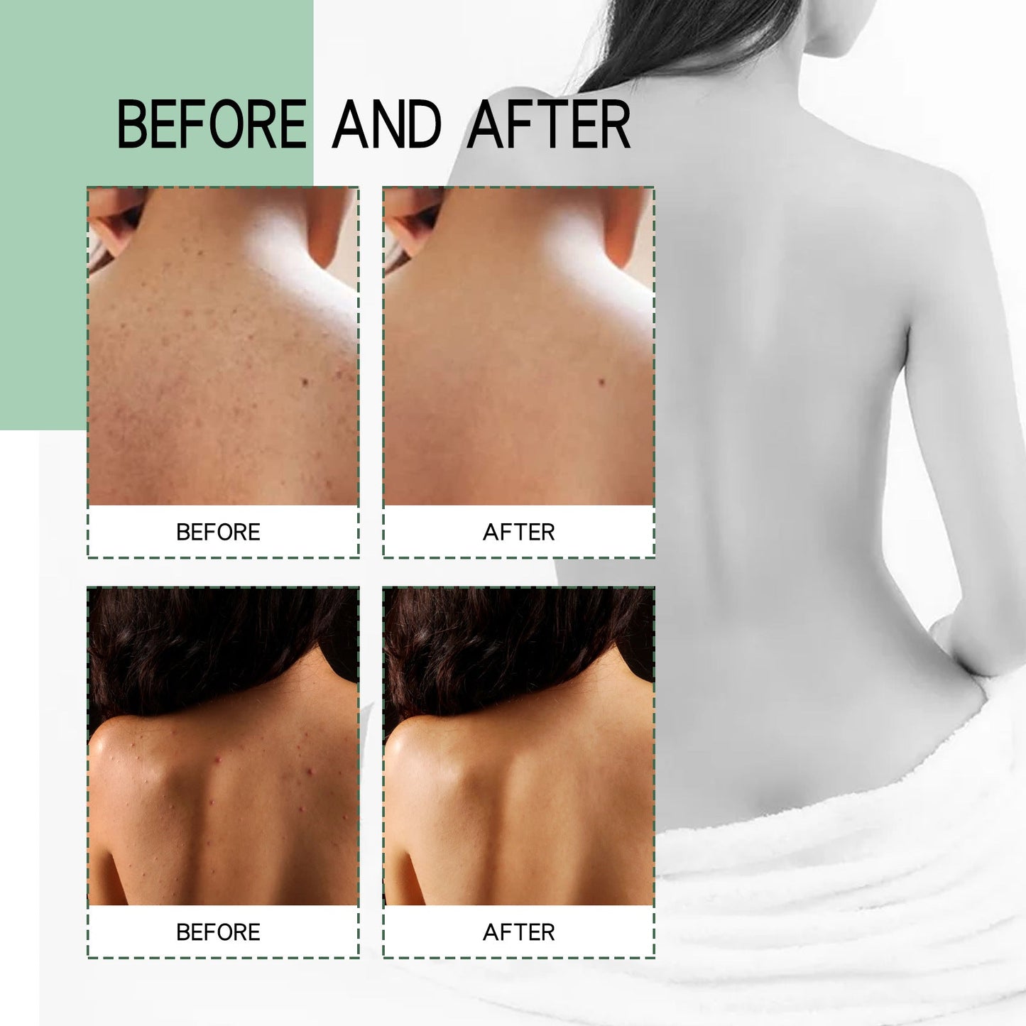 Jaysuing Back Acne Repair Spray បំបាត់ស្នាមមុន ជួសជុលខ្នង ស្មា និងដងខ្លួន សម្អាត និងធ្វើអោយស្បែករលោង 