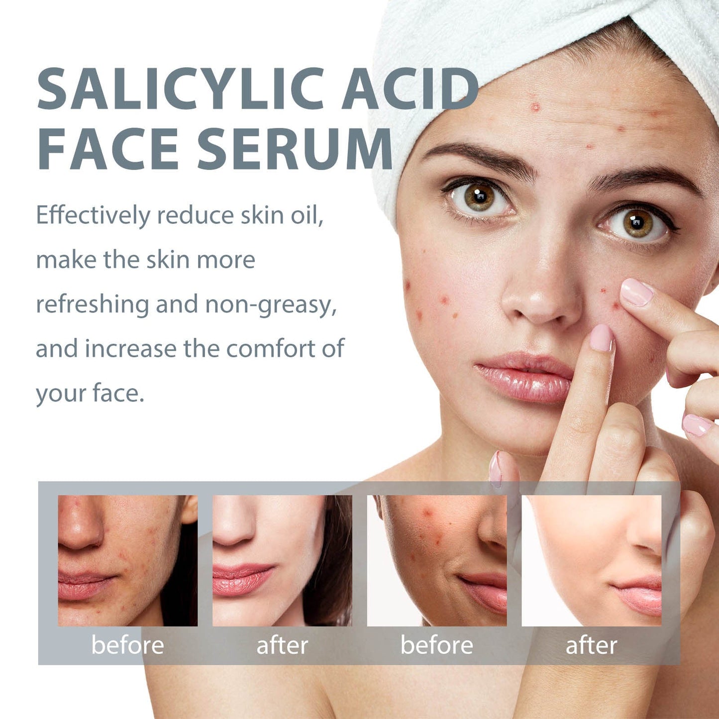 West Month Salicylic Acid Facial Essence, បាត់ស្នាមមុន, ជួសជុល, ផ្តល់សំណើម និងផ្តល់សំណើមដល់ស្បែកមុខ Essence 