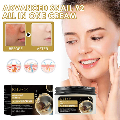 EELHOE Snail 92 Repair Cream Lightens Acne Scars and Acne Skin Moisturizing and Whitening Firming Skin Cream 