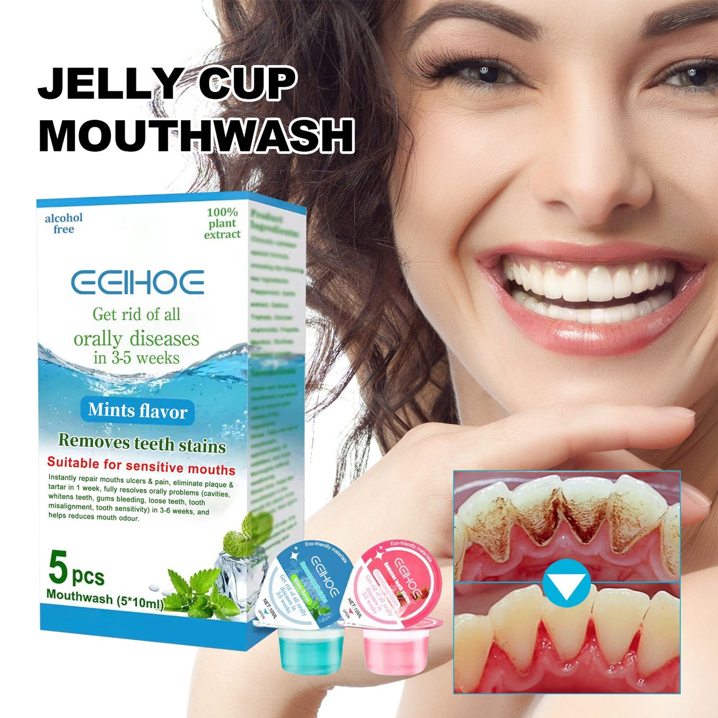 EELHOE jelly cup mouthwash cleans oral odor, tooth stains, smoke stains, whitens teeth care, fresh breath 