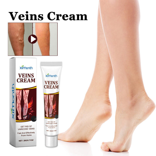 Ximonth Vein Care Cream បំបាត់ការឈឺចាប់ ហើម និងមិនស្រួលដែលបណ្តាលមកពីសរសៃវ៉ែនដែលឡើងលើជើង 